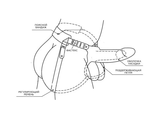 Телесный поясной парапротез - 17 см.