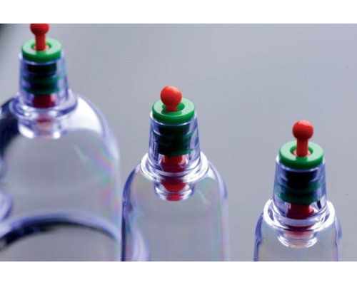 Набор помп для стимуляции Sukshen 6 Piece Cupping Set with Acu-Points